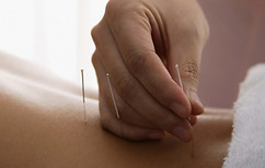 acupuncture-dos.jpg