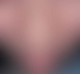 Seu nariz descasca sempre? veja como resolver em casa