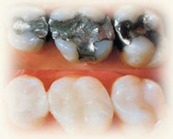 Estética Dental