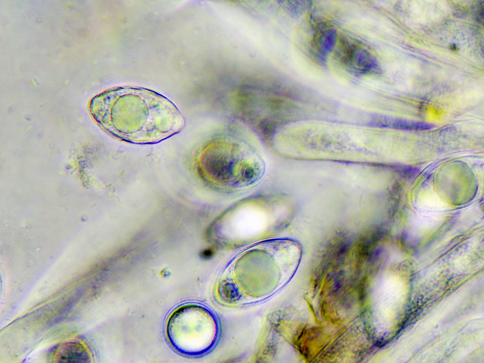 Sporer , 18-24 x 10-12.5 μm; hyaline (2)