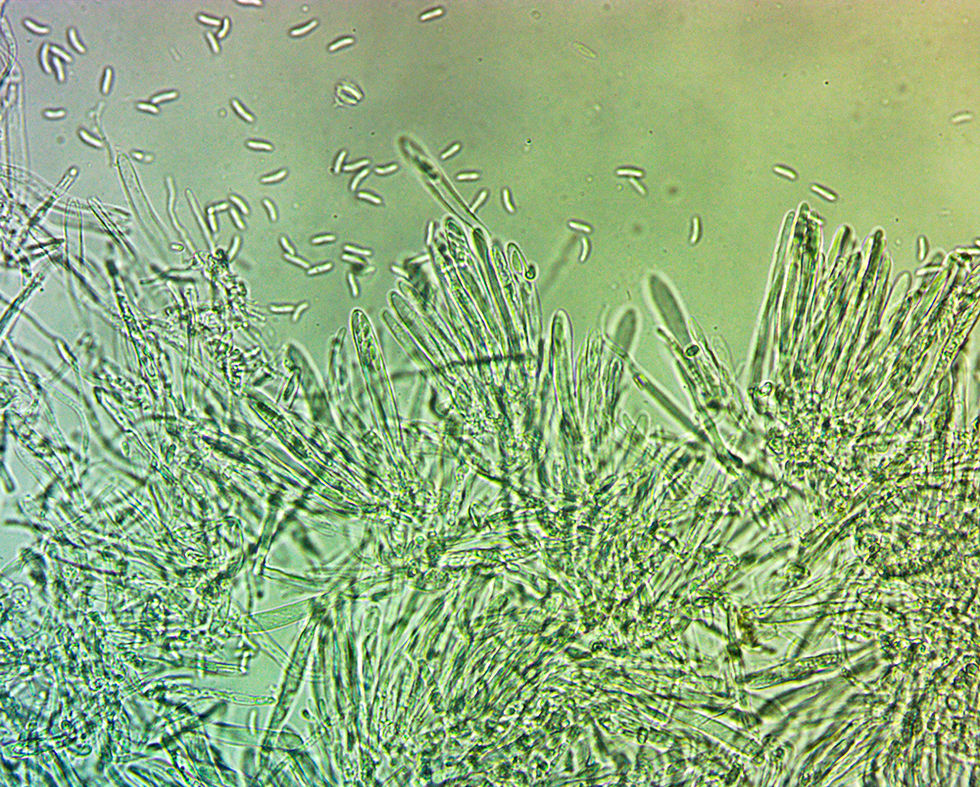 Calycina conorum