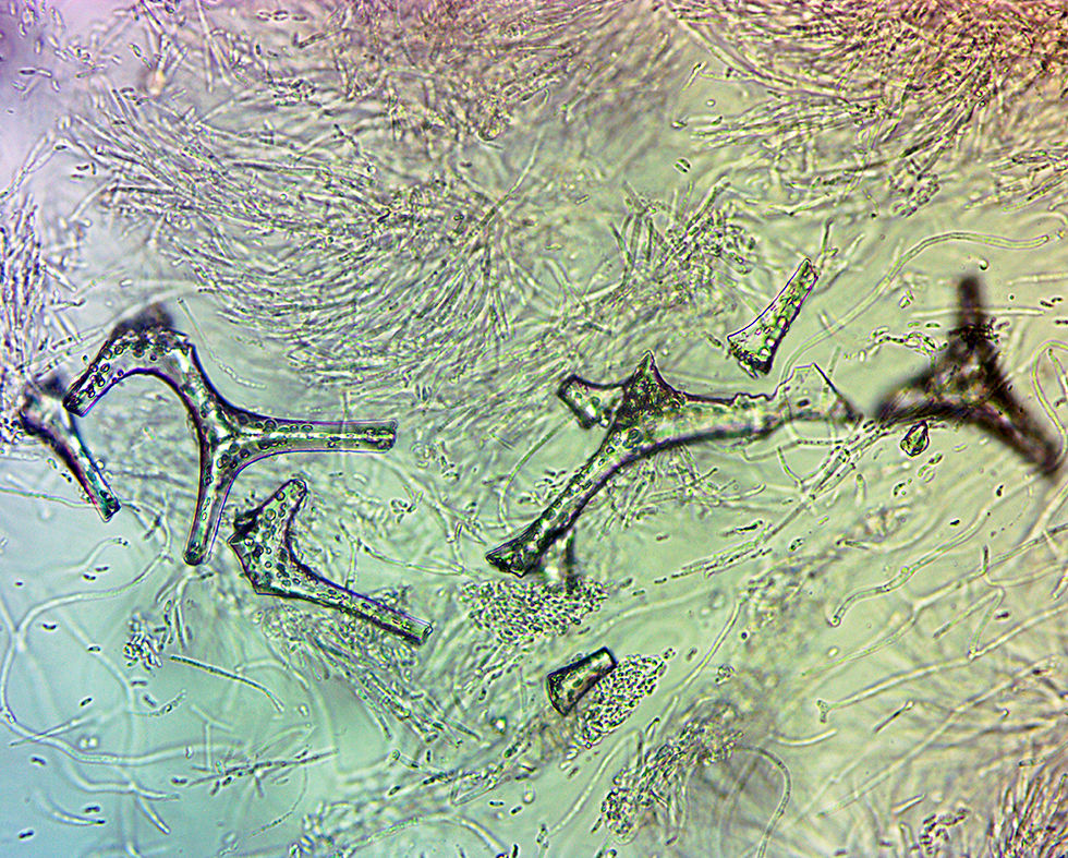 Ascocoryne_sarcoides_-_anamorf_-_Violett