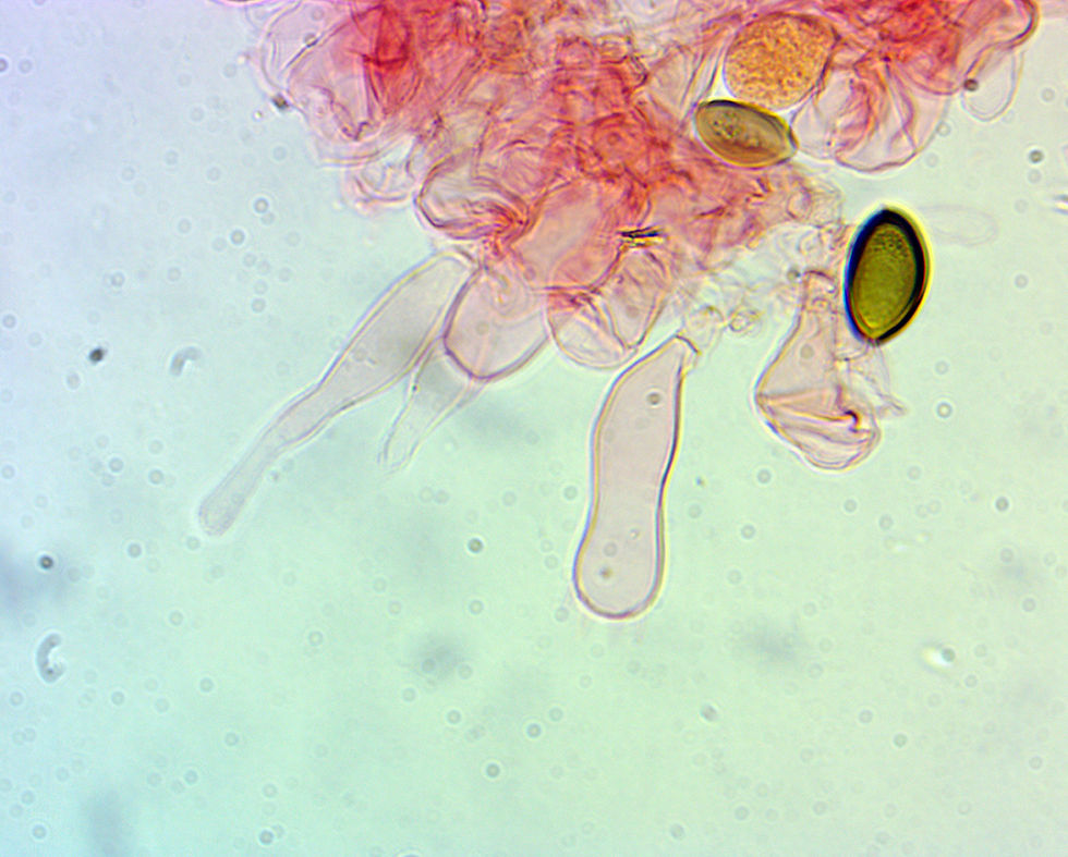 Deconica merdicola. Cheilocystidier (4).