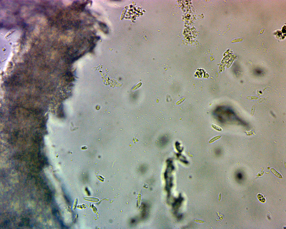 Cryptodiscus_foveolaris