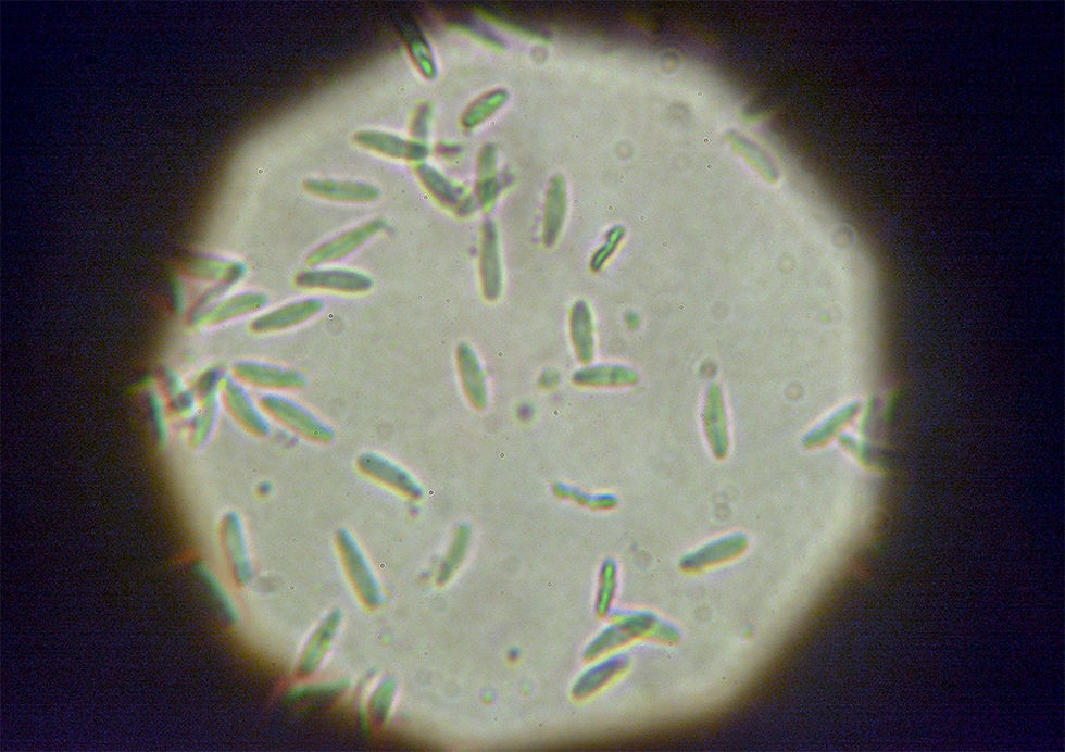 Dasyscyphella nivea (1)