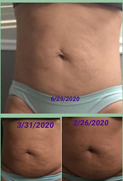 belly pic.jpg