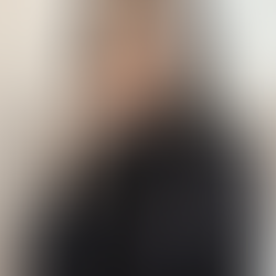 Facetas em Resina: Transforme Seu Sorriso