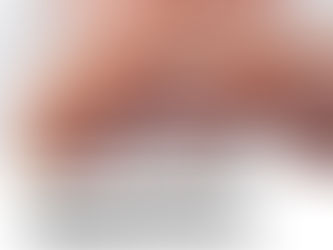 Adultério e Danos Morais: