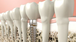 Image-via-Shutterstock.com_-1168x657