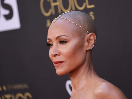 Les Lace Wigs Collées : Quand La Beauté Capillaire Peut Devenir Risquée