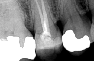 digital-radiographs-dental-office-calgar