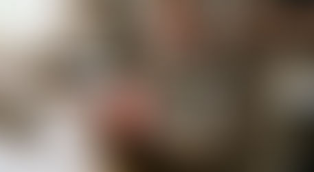 Açougueiro tem mão amputada após acidente de trabalho em supermercado de Canoinhas