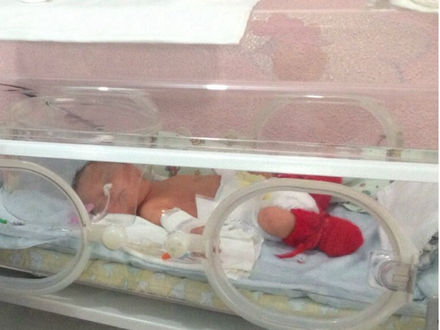 Bebê nasce dois meses após
a bolsa da mãe estourar em SC