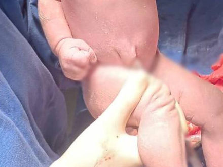 ​Nota Oficial: Esclarecimento sobre Intercorrência com Recém-Nascida no HSCC