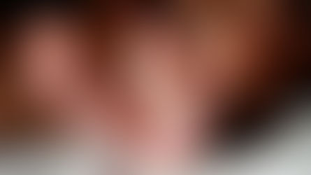 Saúde de Três Barras alerta sobre síndrome que atinge mãos, pés e bocas de crianças pequenas