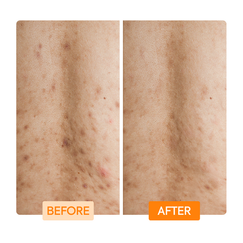 Gel douche à l'acide glycolique, lactique et niacinamide-IYKYK