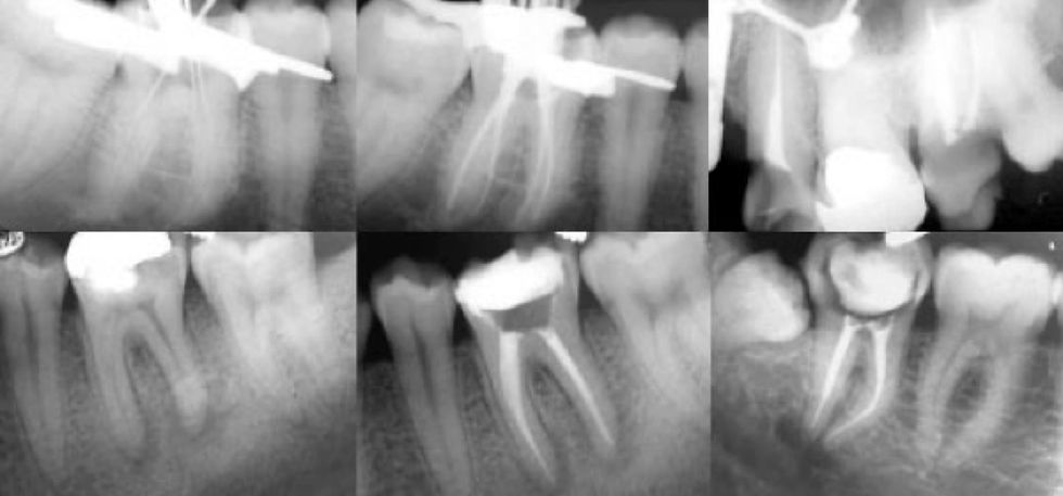 Endo 3