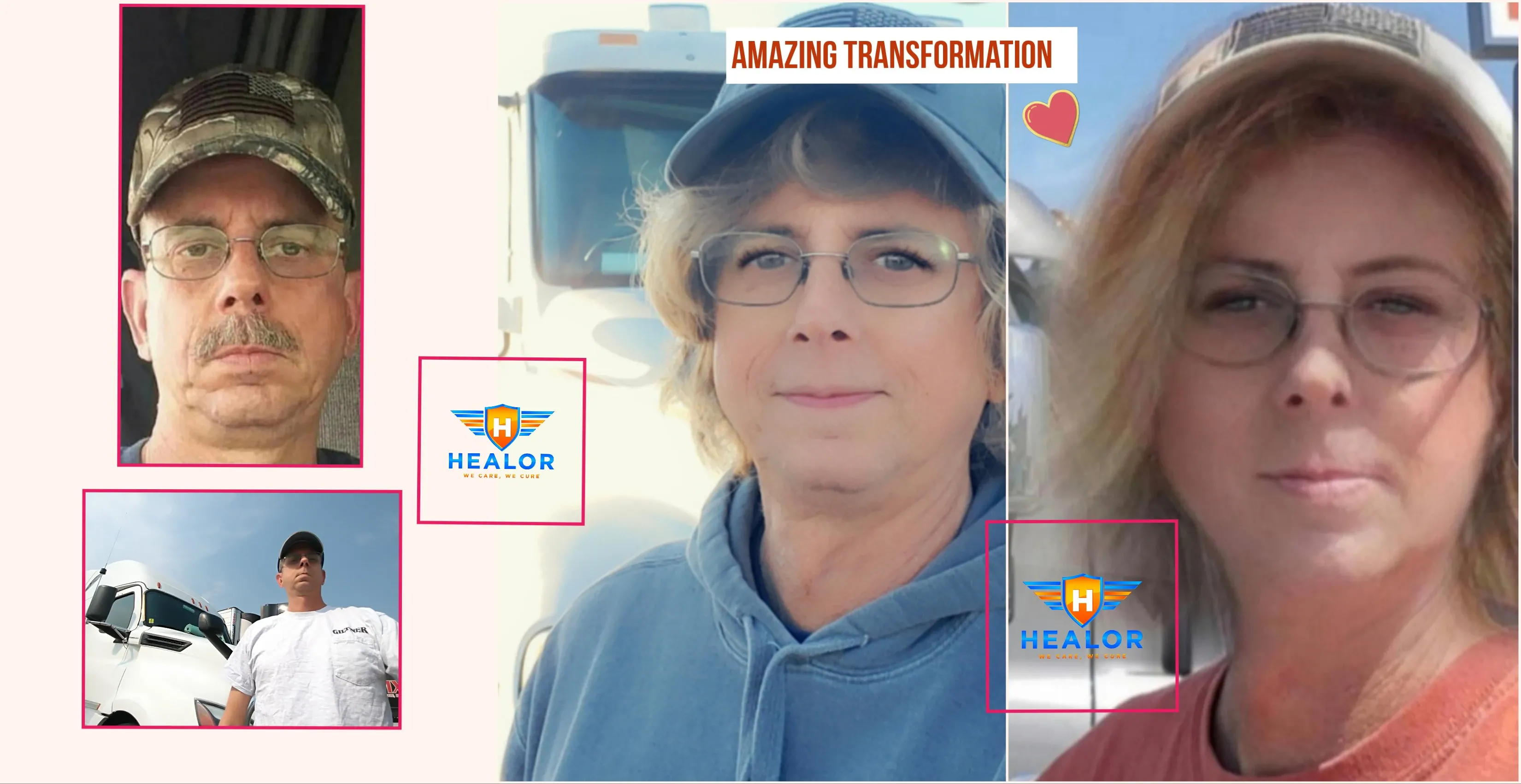 transgender MTF before after at HEALOR