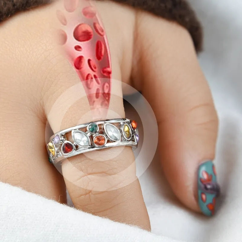 Miniatura: Anillo de terapia 