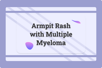 Armpit Rash with Multiple Myeloma: What You Need to Know