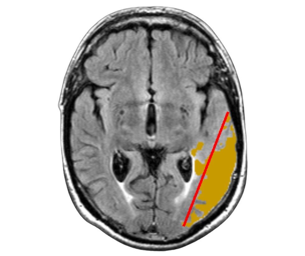 brain-visual-new-Milan.png