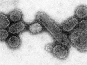 Characterization of the Reconstructed 1918 Spanish Influenza Pandemic Virus