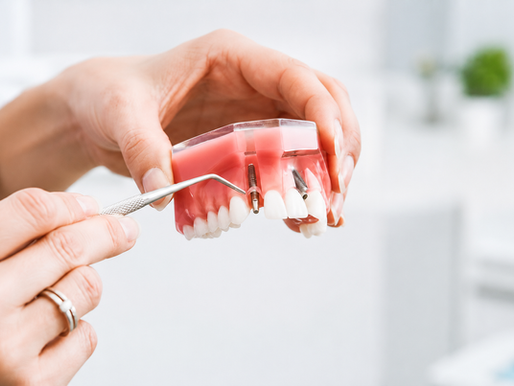Dental Implant Cost in Delhi treatment model at Silver Crest Dental Studio