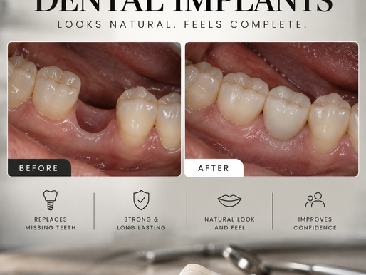 dental-implants-before-after-silver-crest-dental-studio.png