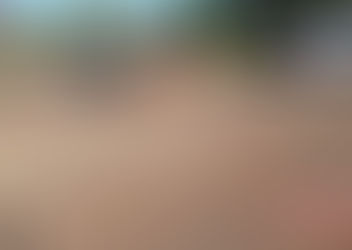 Colisão envolve carro e moto e deixa uma pessoa ferida no trevo de acesso a Independência