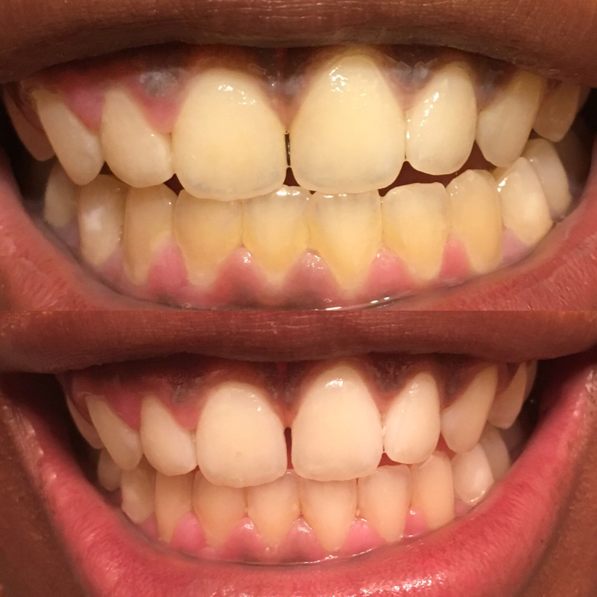 Natural Toothpowder (6ml)