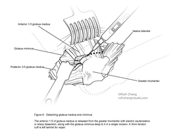 Detaching glut med and min