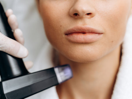 Laser Hair Removal Cost in West Delhi: Prices, Sessions & What Affects It