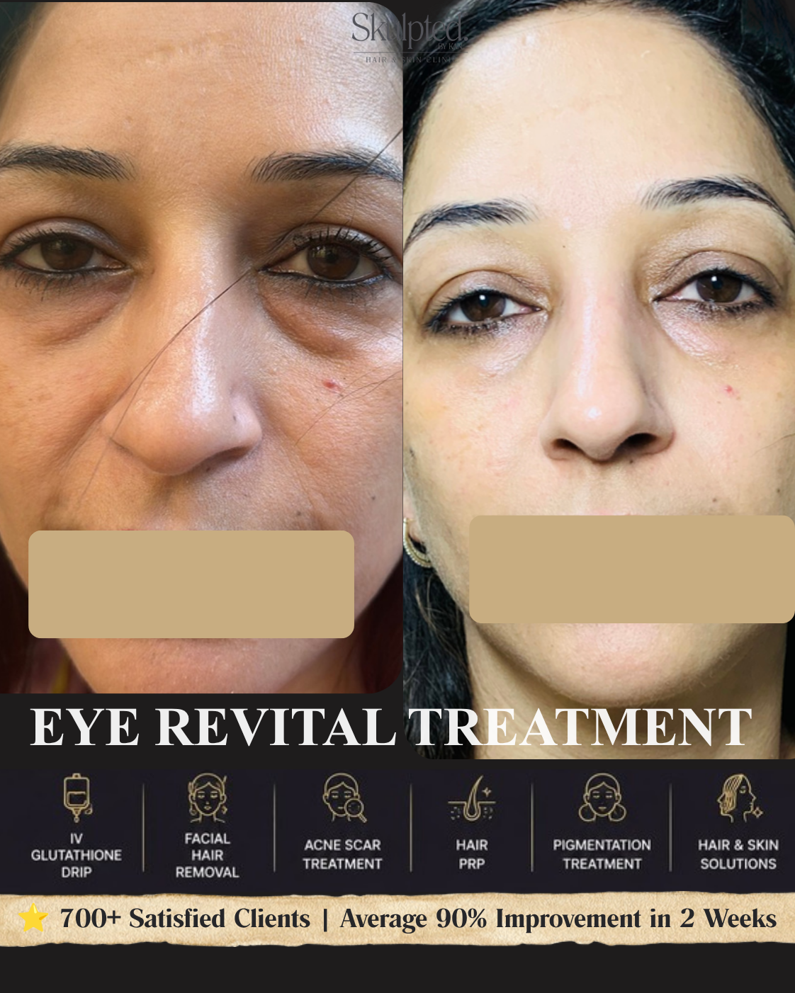 Real Skulpted client — brighter, more even skin, before & after