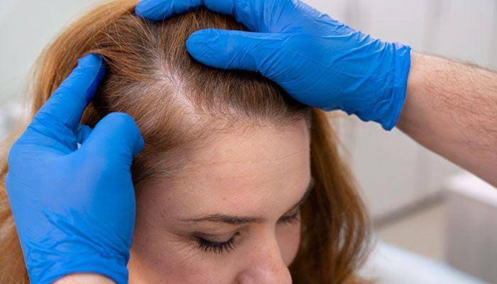 A person wearing gloves revealing hairline of a woman 