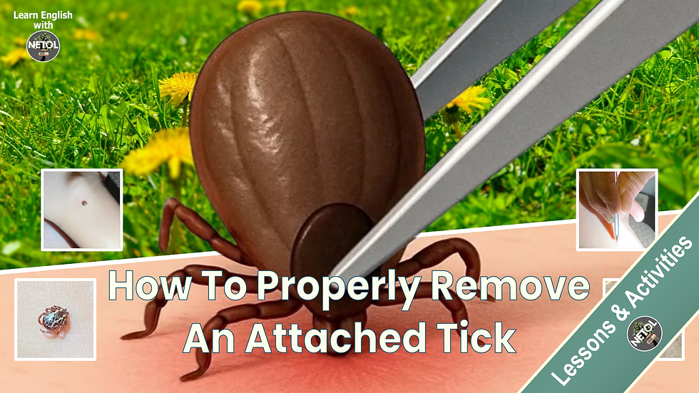 Tick Lesson - Learn English with NETOL