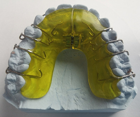 Dental Brace