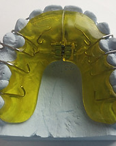 Dental Brace