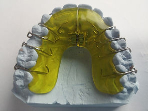 Dental Brace