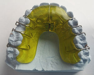 Dental Brace