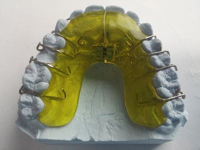 Aparelho ortodôntico, aparelho ortopédico móvel, dentes retos, sorriso bonito, dentes tortos
