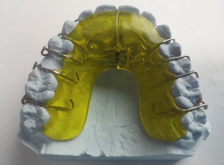 Dental Brace