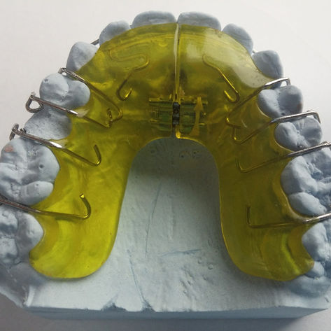 Retainers (Removable + Bonded Wire)
