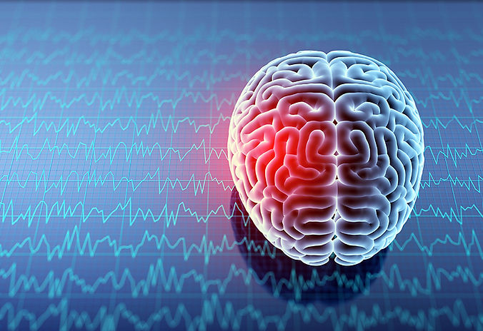 Concussion Protocol