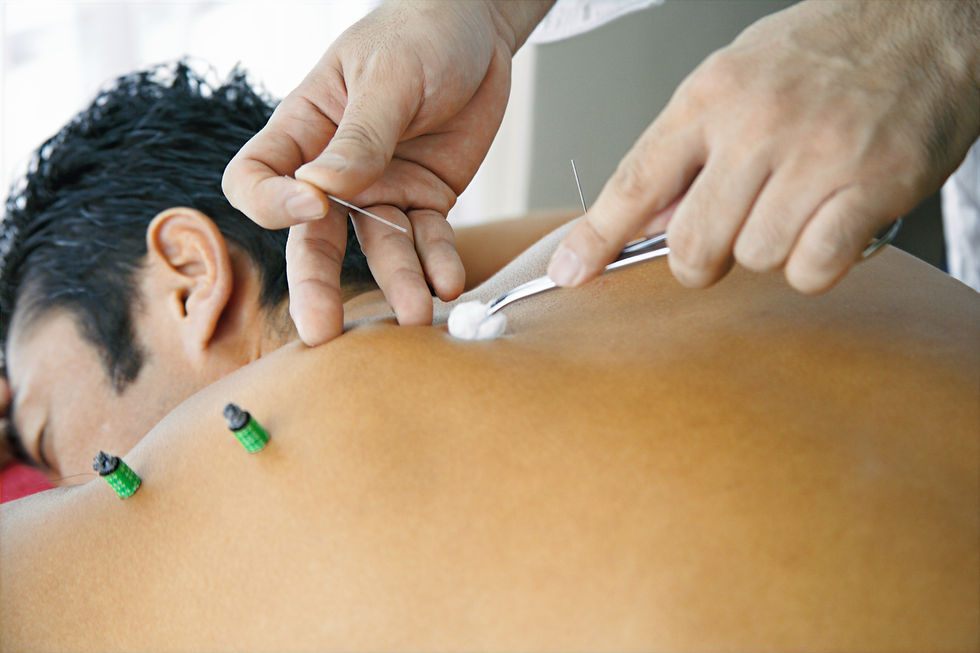 Acupuncture Gold Coast Southport, Southport acupuncture services, Gold Coast acupuncture clinic, Queensland acupuncture practitioner, John Deare acupuncture