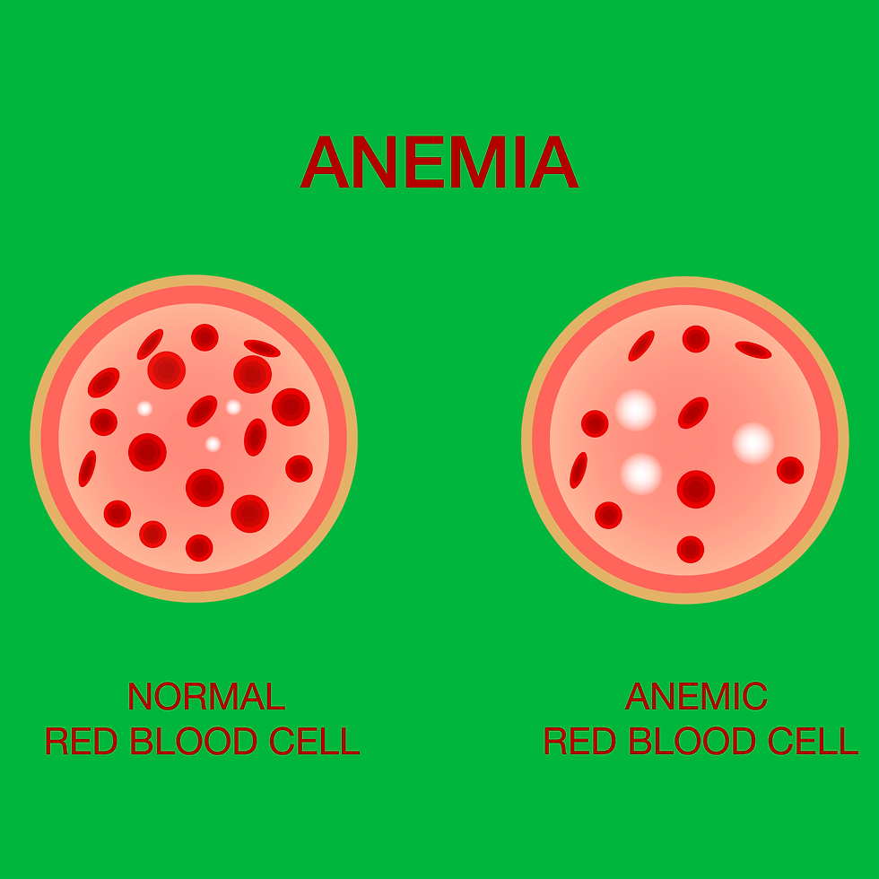 Anemia