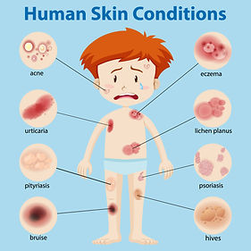 Skin Issues