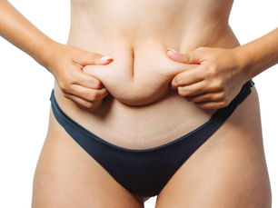 What to Expect Before Your First CoolSculpting Session
