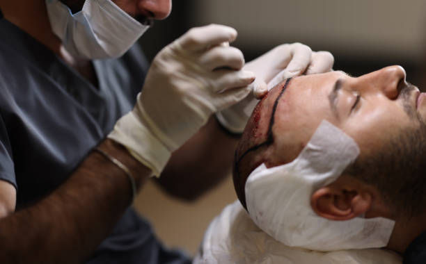 What Makes Hair Transplant Results Look So Permanent