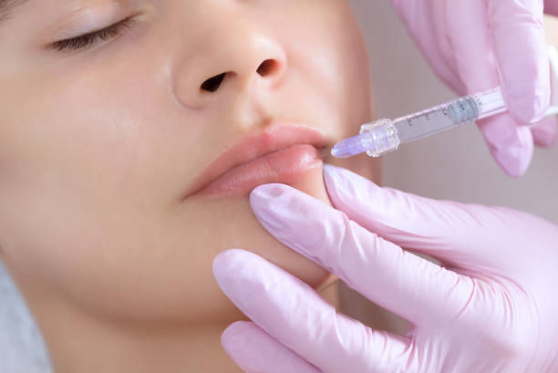 How to Choose the Best Lip Fillers Injection Type
