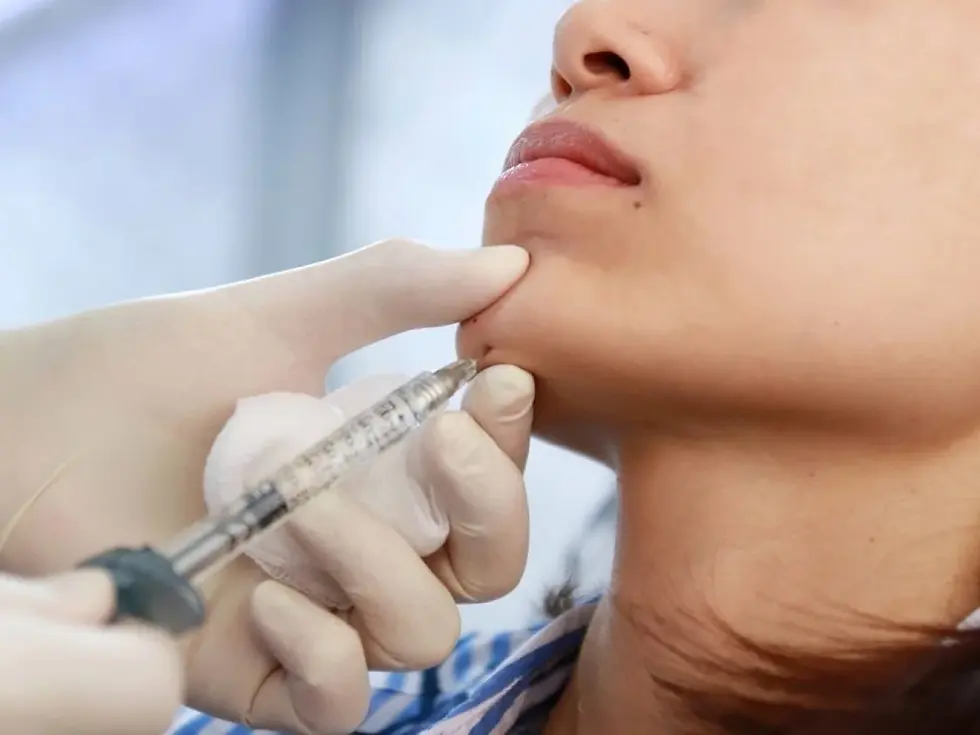 Does Jawline Filler Injections Last Long on Average